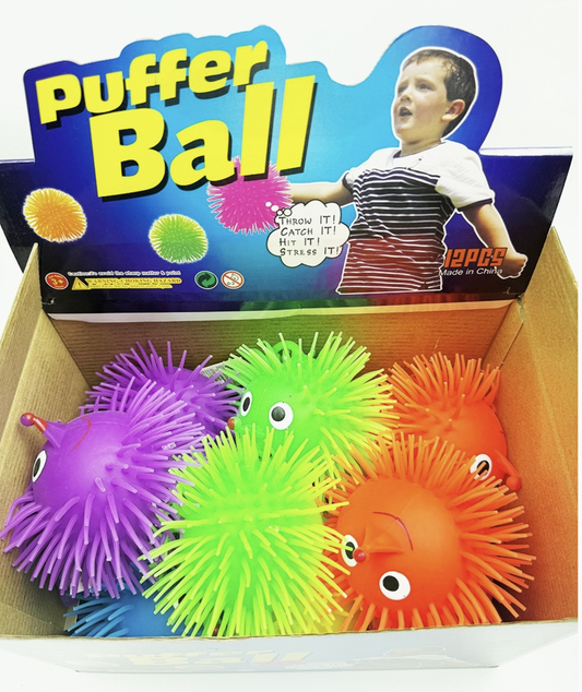 7 Inch Spiky Stress Neon Ball